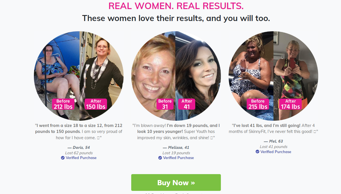 Skinny Fit Super Youth